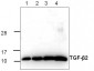 TGF-beta2 Antibody